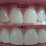 Cosmetic dentistry