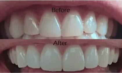The Advantages of Holistic Cosmetic Dentistry Over Conventional Cosmetic Dentistry