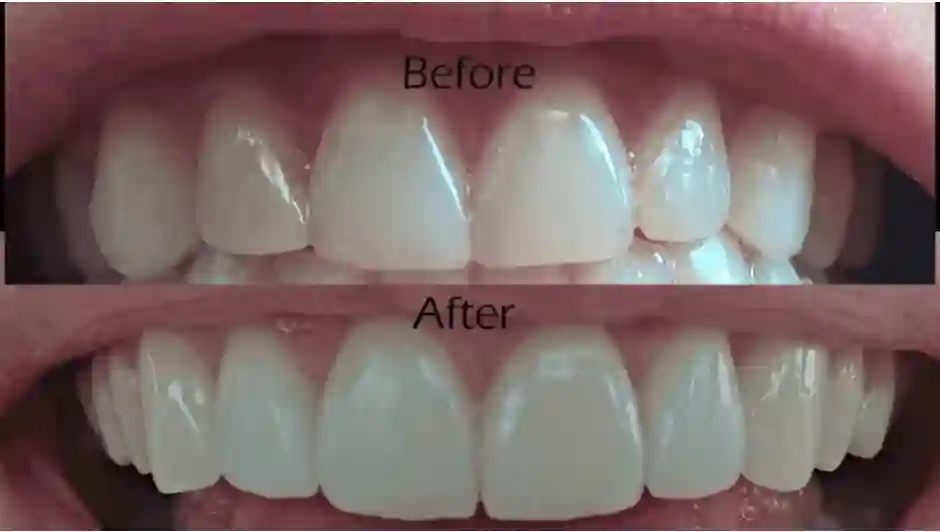The Advantages of Holistic Cosmetic Dentistry Over Conventional Cosmetic Dentistry